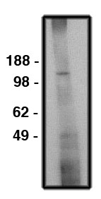 "
Western blot using NHE6 antibody (Cat. No. X2343P) on human brain lysate (15 µg/lane).  Antibody used at 10 µg/ml.  Secondary antibody, mouse anti-rabbit (Cat. No. X1207M), used at 1:150K dilution."